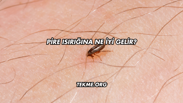 Pire Isırığına Ne İyi Gelir?