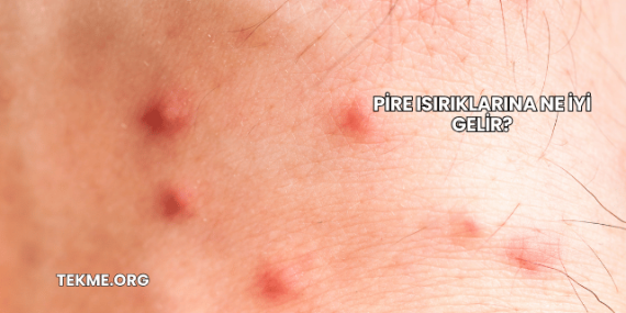 Pire Isırıklarına Ne İyi Gelir?