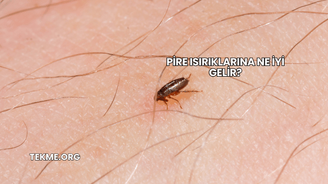 Pire Isırıklarına Ne İyi Gelir?