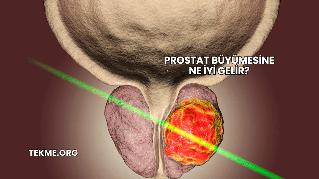 Prostat Büyümesine Ne İyi Gelir?