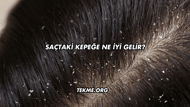 Saçtaki Kepeğe Ne İyi Gelir?
