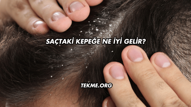 Saçtaki Kepeğe Ne İyi Gelir?