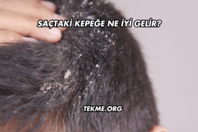 Saçtaki Kepeğe Ne İyi Gelir?