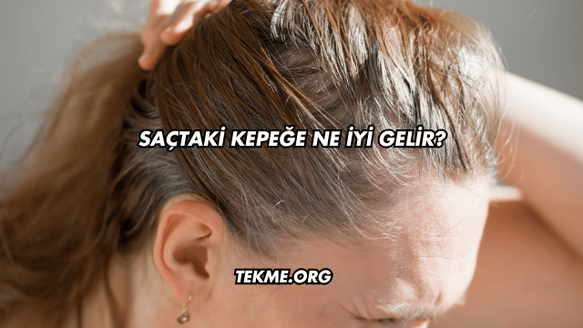 Saçtaki Kepeğe Ne İyi Gelir?