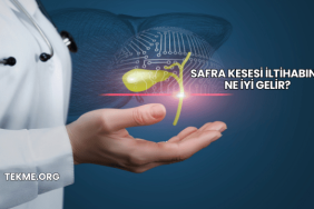 Safra Kesesi İltihabına Ne İyi Gelir?