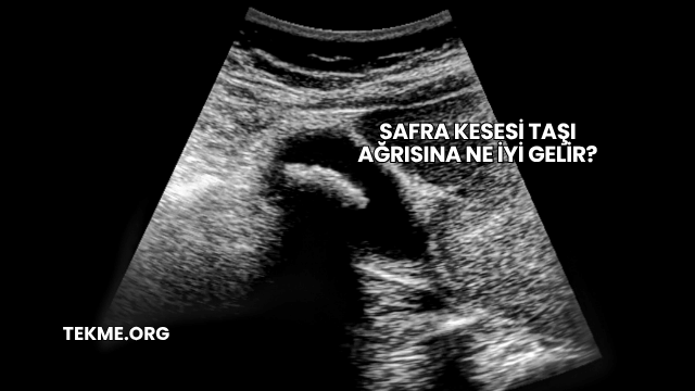 Safra Kesesi Taşı Ağrısına Ne İyi Gelir?