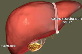 Safra Kesesine Ne İyi Gelir?
