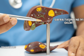 Safra Taşına Ne İyi Gelir?