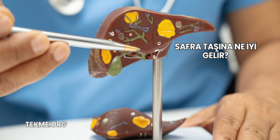 Safra Taşına Ne İyi Gelir?
