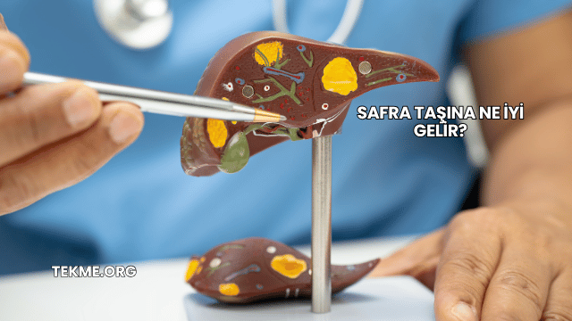 Safra Taşına Ne İyi Gelir?
