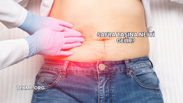 Safra Taşına Ne İyi Gelir?