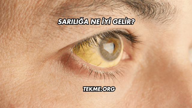Sarılığa Ne İyi Gelir?