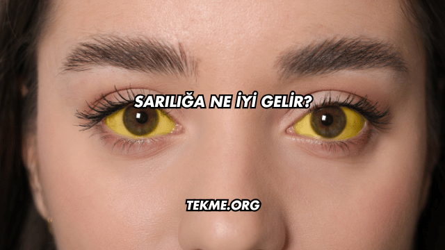 Sarılığa Ne İyi Gelir?