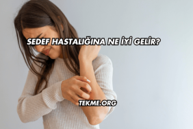 Sedef Hastalığına Ne İyi Gelir?