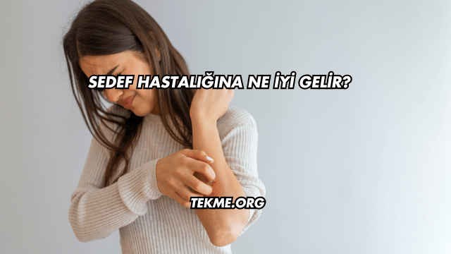 Sedef Hastalığına Ne İyi Gelir?