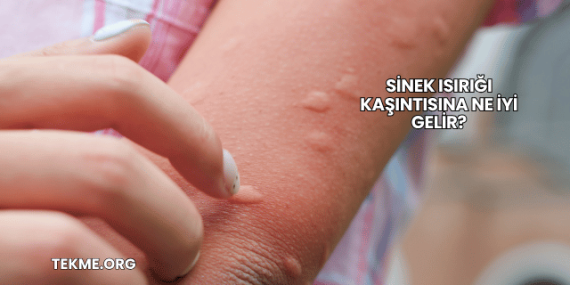 Sinek Isırığı Kaşıntısına Ne İyi Gelir?