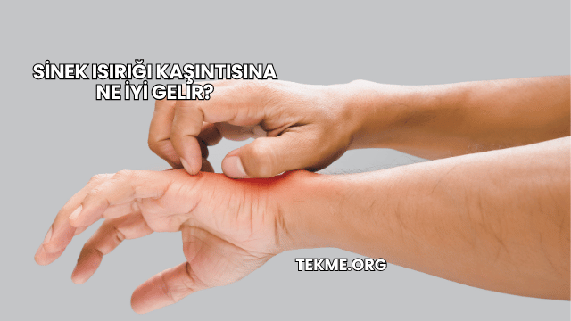 Sinek Isırığı Kaşıntısına Ne İyi Gelir?