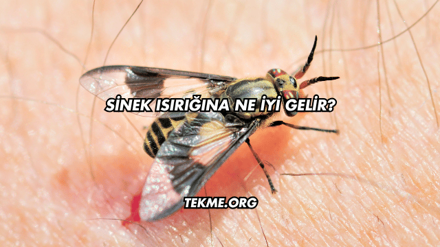 Sinek Isırığına Ne İyi Gelir?