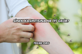 Sinek Kaşıntısına Ne İyi Gelir?