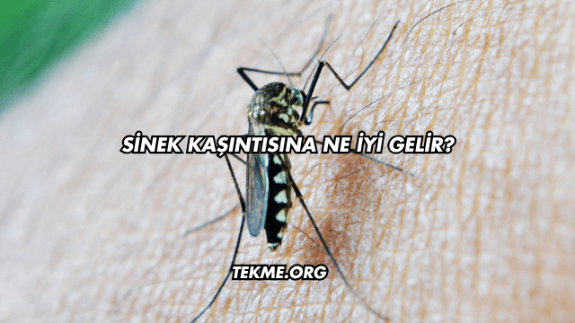 Sinek Kaşıntısına Ne İyi Gelir?