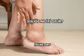 Şişliğe Ne İyi Gelir?