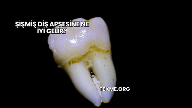 Şişmiş Diş Apsesine Ne İyi Gelir?