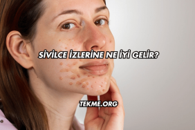 Sivilce İzlerine Ne İyi Gelir?