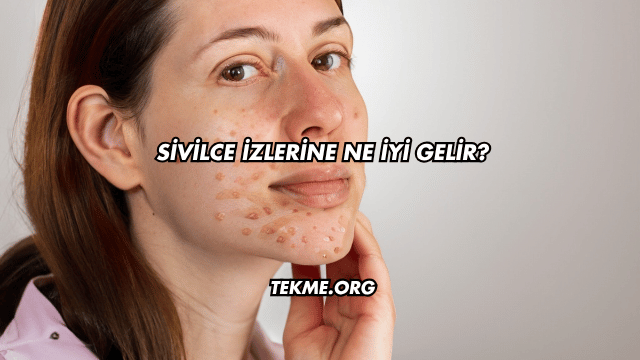 Sivilce İzlerine Ne İyi Gelir?