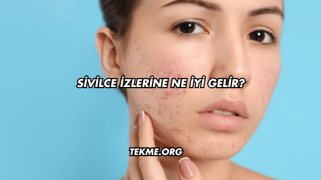 Sivilce İzlerine Ne İyi Gelir?