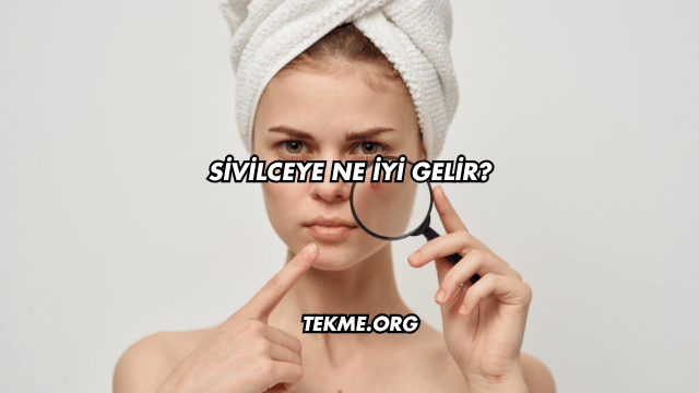 Sivilceye Ne İyi Gelir?