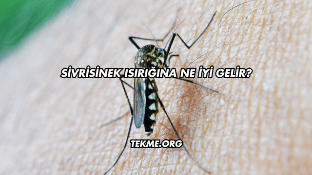 Sivrisinek Isırığına Ne İyi Gelir?