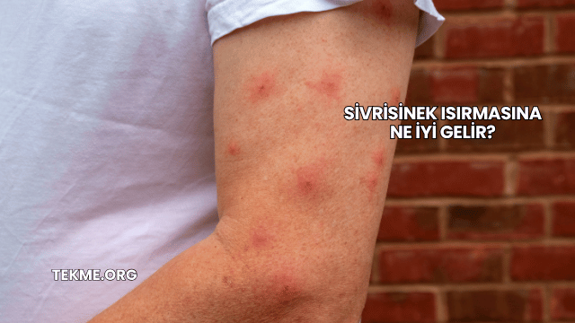 Sivrisinek Isırmasına Ne İyi Gelir?