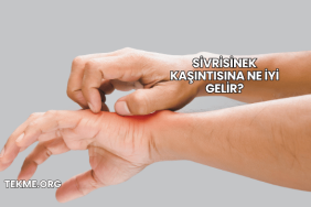 Sivrisinek Kaşıntısına Ne İyi Gelir?