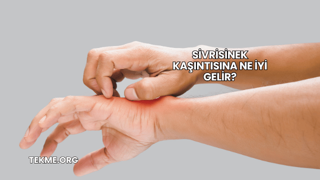 Sivrisinek Kaşıntısına Ne İyi Gelir?
