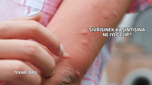 Sivrisinek Kaşıntısına Ne İyi Gelir?