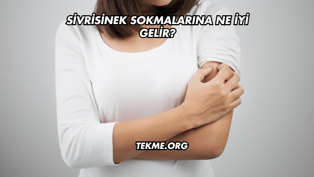 Sivrisinek Sokmalarına Ne İyi Gelir?
