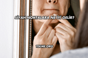 Siyah Noktalara Ne İyi Gelir?