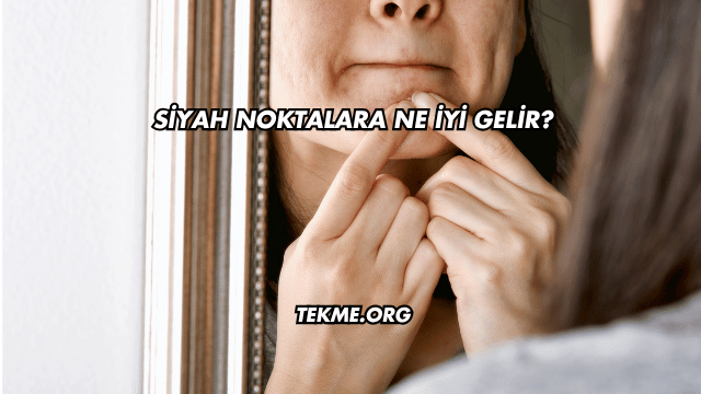 Siyah Noktalara Ne İyi Gelir?