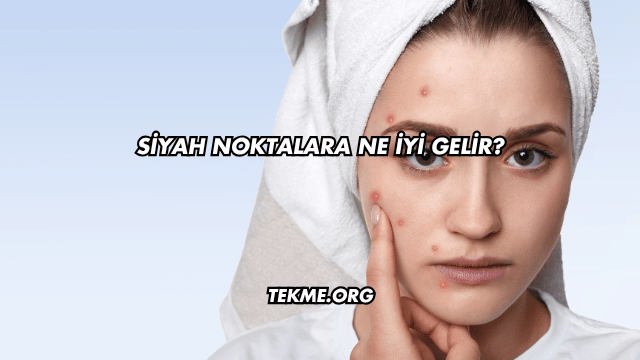 Siyah Noktalara Ne İyi Gelir?