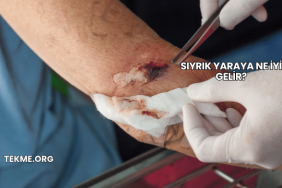 Sıyrık Yaraya Ne İyi Gelir?