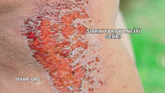 Sıyrık Yaraya Ne İyi Gelir?