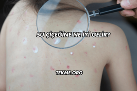 Su Çiçeğine Ne İyi Gelir?