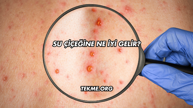 Su Çiçeğine Ne İyi Gelir?