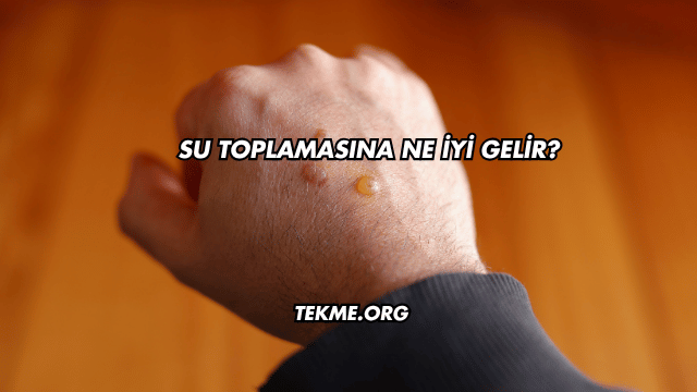 Su Toplamasına Ne İyi Gelir?