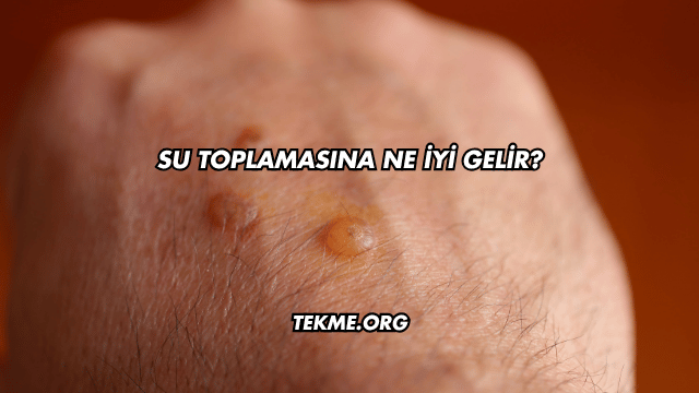Su Toplamasına Ne İyi Gelir?
