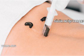 Sülük Ne İşe Yarar?