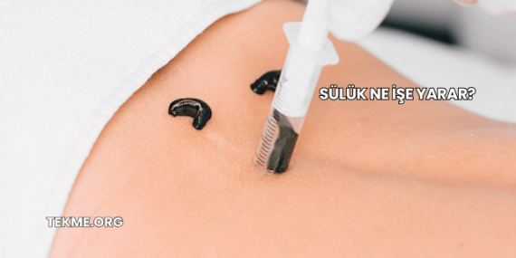 Sülük Ne İşe Yarar?