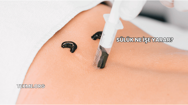 Sülük Ne İşe Yarar?