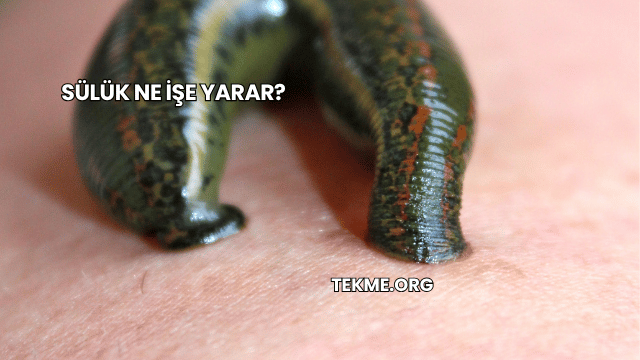 Sülük Ne İşe Yarar?