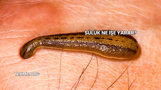 Sülük Ne İşe Yarar?